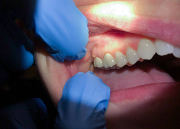 Best Emergency Dental Clinic in NE